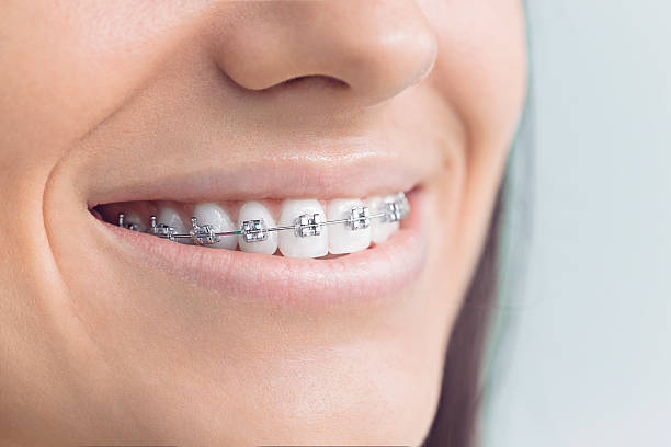 Best Dental Fillings (Composite and Amalgam)  in Salem, IL